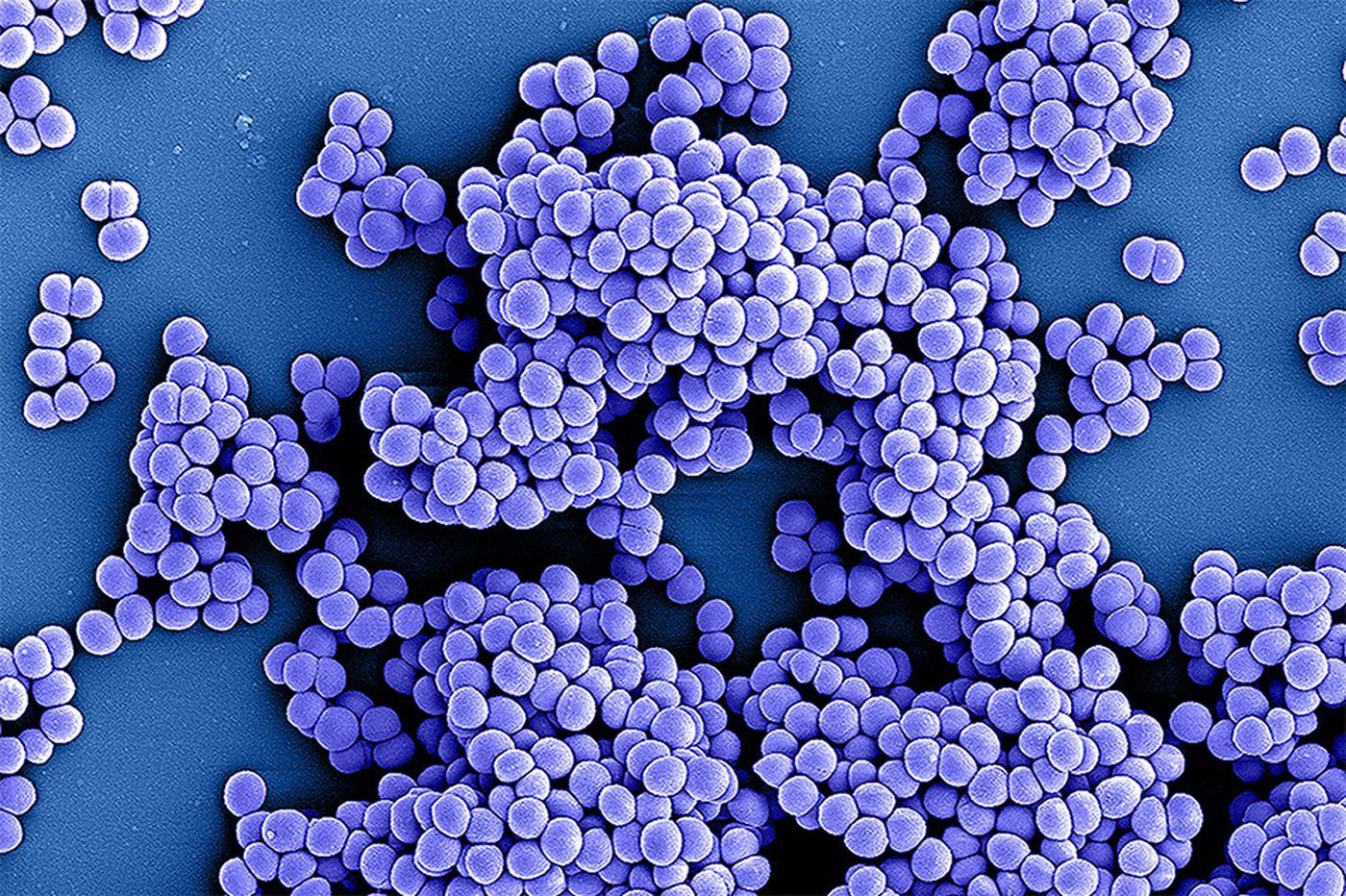 Drugresistant superbugs projected to kill 39 million by 2050 ABSCBN