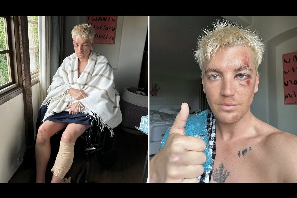 LANY postpones tour following Paul Klein’s accident ABSCBN Entertainment