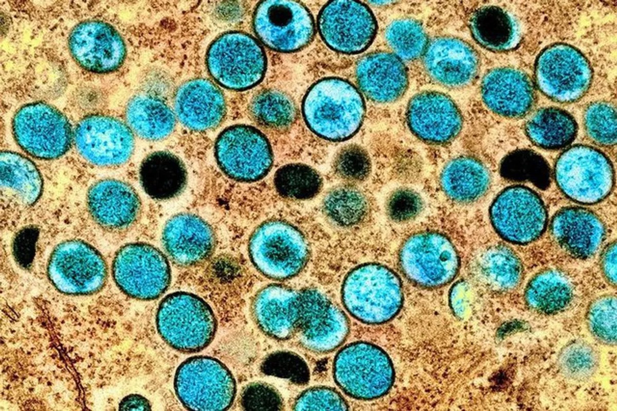 DOH: Sex not only form of contact that puts people at risk for mpox ...