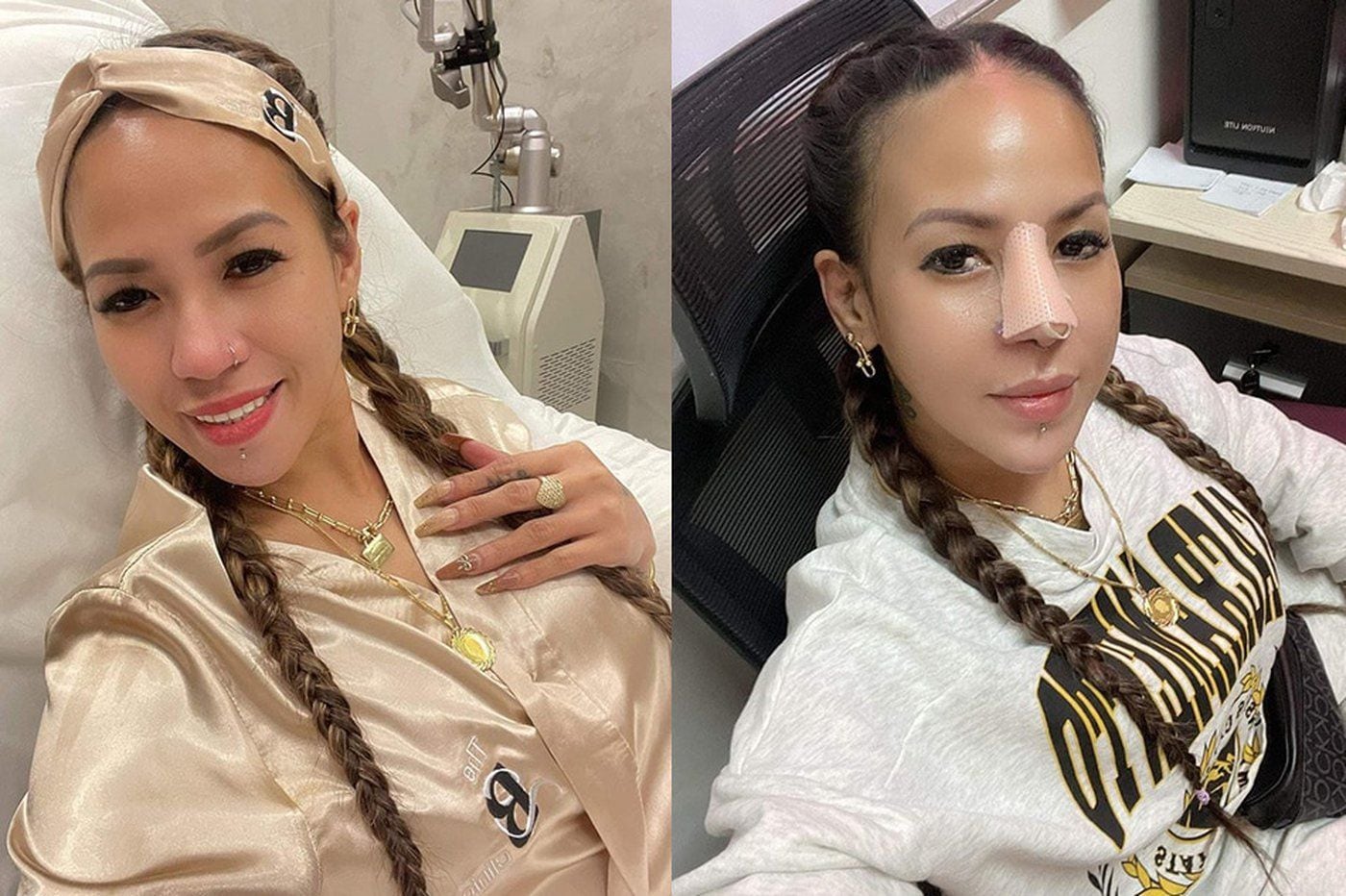 Pangarap ko noon pa': Madam Inutz nagparetoke ng ilong ng libre | ABS-CBN  Entertainment