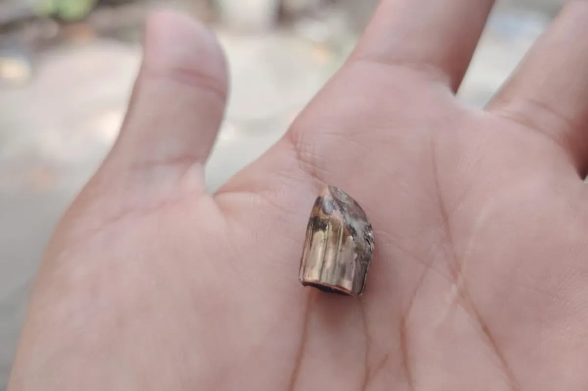 11yearold grazed by stray bullet in North Caloocan ABSCBN News(00)