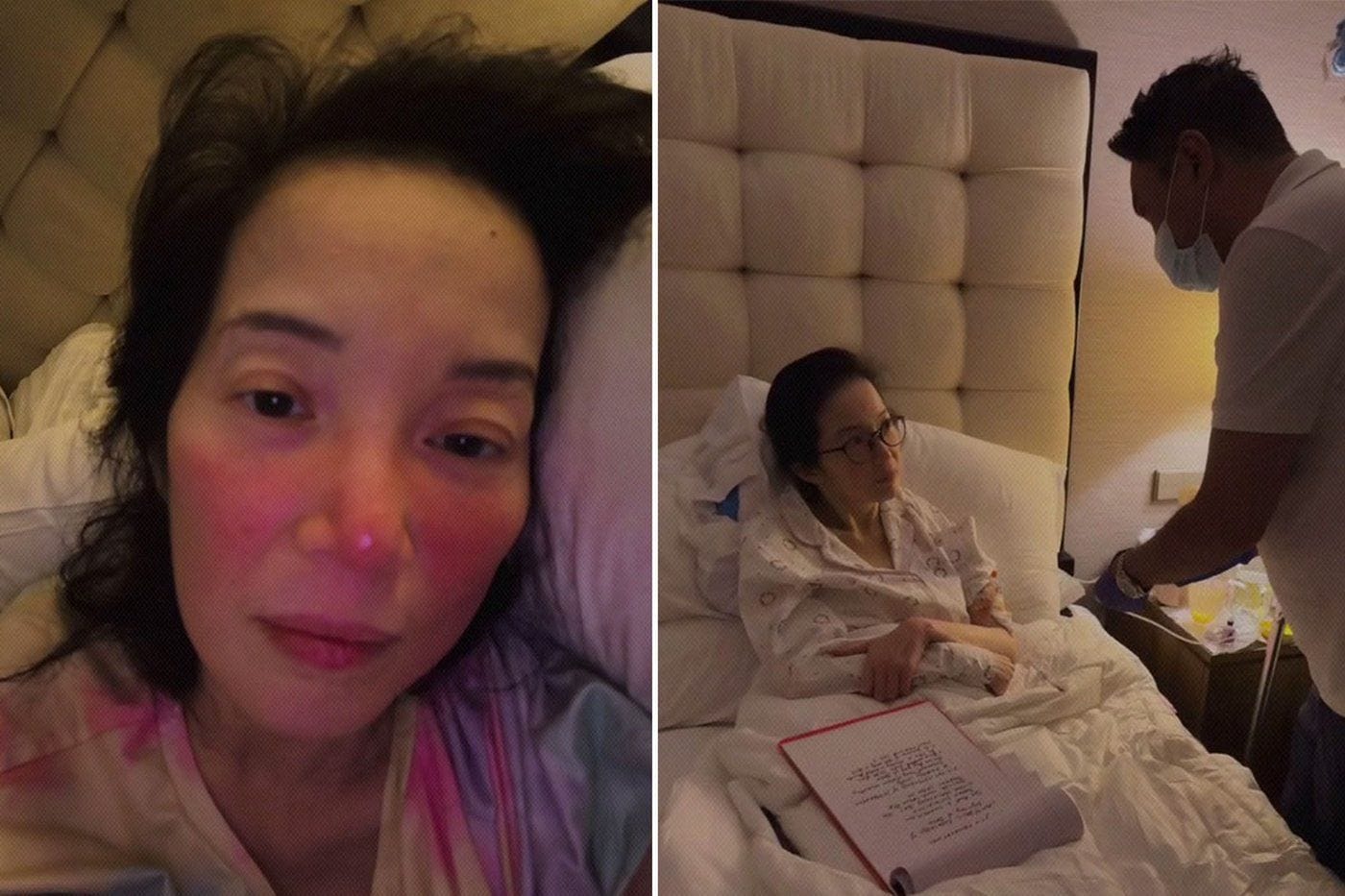 Lupus Flare Fever