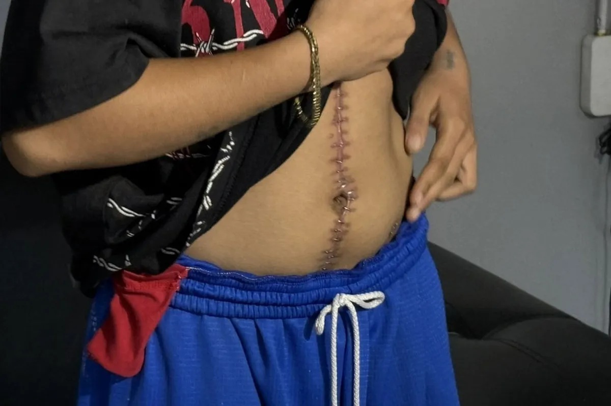 Frau von Freund angeschossen, als sie versuchte, fehlenden P700 zu finden ...