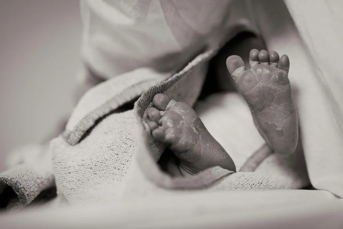 Baby born to braindead US woman kept alive due to abortion law ABS