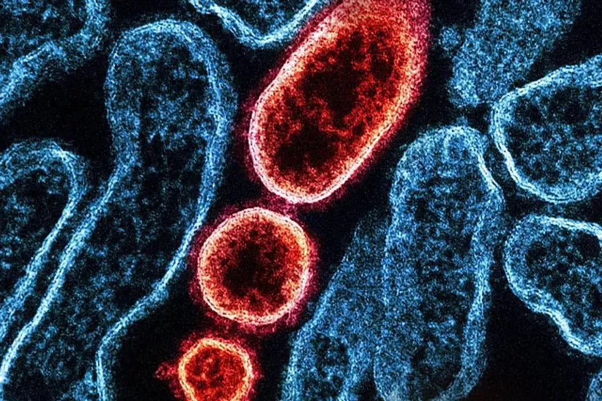 Deadly Nipah virus deemed 'limited' by scientists | ABS-CBN News