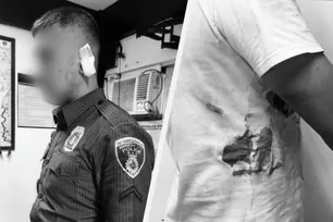 Dalawang pulis inatake, kinagat umano sa tenga ng lalaki sa Marikina