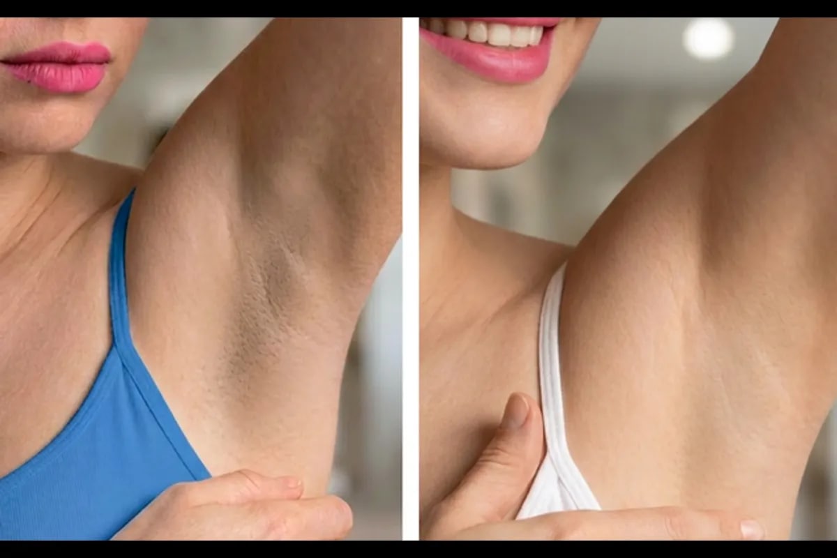 Dark underarms? Local brand reimagines traditional tawas